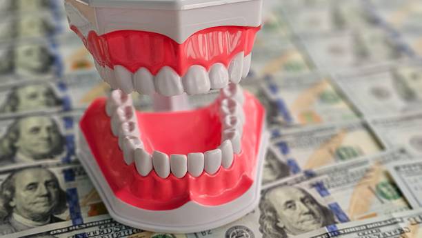 Are Implant Dentures Worth the Investment? – Telegraph